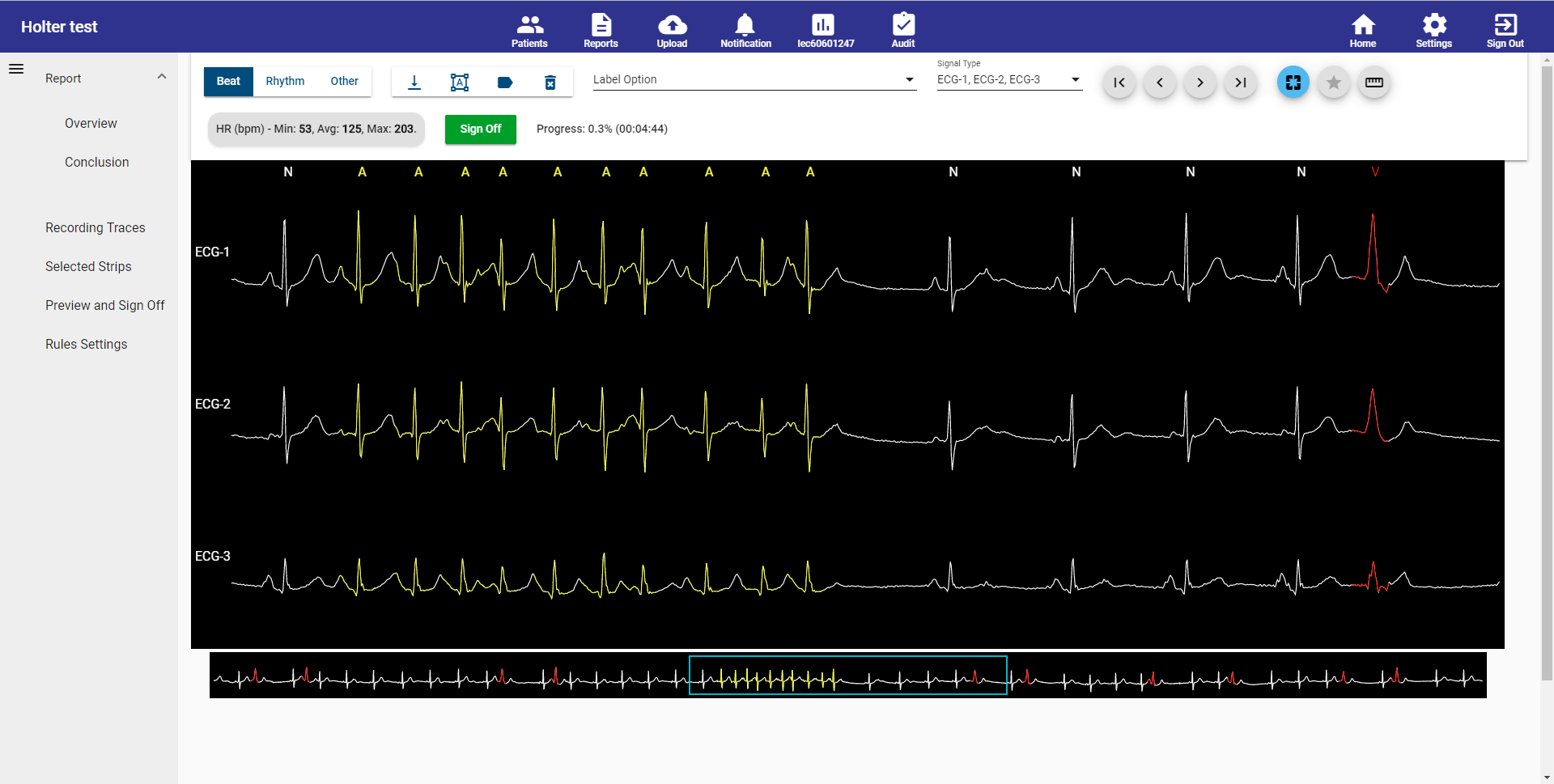 Holter-detail-1.png